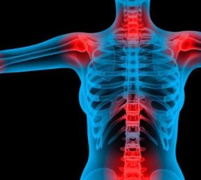Fibromialgia: consigli nutrizionali nel dolore cronico
